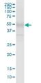 Putative phosphatidylinositol 4-kinase alpha-like protein P2 antibody, H00375133-B01P, Novus Biologicals, Western Blot image 