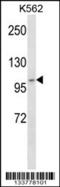 ADAM Metallopeptidase With Thrombospondin Type 1 Motif 5 antibody, 57-305, ProSci, Western Blot image 