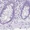 Ankyrin Repeat Domain 45 antibody, PA5-56811, Invitrogen Antibodies, Immunohistochemistry frozen image 
