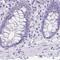 Ankyrin Repeat Domain 45 antibody, PA5-56811, Invitrogen Antibodies, Immunohistochemistry frozen image 