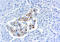 TIMP Metallopeptidase Inhibitor 2 antibody, GTX21828, GeneTex, Immunohistochemistry paraffin image 