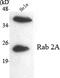 RAB2A, Member RAS Oncogene Family antibody, M06007-1, Boster Biological Technology, Western Blot image 