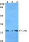 Mitochondrially Encoded ATP Synthase Membrane Subunit 6 antibody, PA5-37129, Invitrogen Antibodies, Western Blot image 