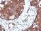 STAM Binding Protein antibody, PA5-29187, Invitrogen Antibodies, Immunohistochemistry frozen image 