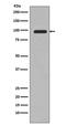 Phosphatidylinositol 3-Kinase Catalytic Subunit Type 3 antibody, M02356, Boster Biological Technology, Western Blot image 