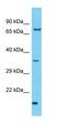 Transmembrane Protein 150C antibody, orb327124, Biorbyt, Western Blot image 