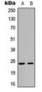 Cyclin Dependent Kinase Inhibitor 1B antibody, LS-C358941, Lifespan Biosciences, Western Blot image 