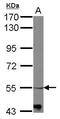 Adrenoceptor Alpha 1B antibody, PA5-27120, Invitrogen Antibodies, Western Blot image 