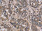 Fibrinogen Like 2 antibody, CSB-PA175167, Cusabio, Immunohistochemistry paraffin image 