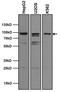 Aryl Hydrocarbon Receptor antibody, GTX22770, GeneTex, Western Blot image 
