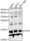T Cell Leukemia Translocation Altered antibody, A10410, Boster Biological Technology, Western Blot image 