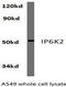 Inositol Hexakisphosphate Kinase 2 antibody, AP01285PU-N, Origene, Western Blot image 