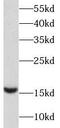 Baculoviral IAP repeat-containing protein 5 antibody, FNab09909, FineTest, Western Blot image 