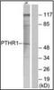 Parathyroid Hormone 1 Receptor antibody, orb94572, Biorbyt, Western Blot image 