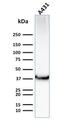 Solute Carrier Family 2 Member 1 antibody, GTX17991, GeneTex, Western Blot image 