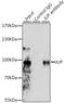 Junction Plakoglobin antibody, LS-C331167, Lifespan Biosciences, Immunoprecipitation image 