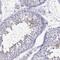 Cilia And Flagella Associated Protein 70 antibody, NBP2-62668, Novus Biologicals, Immunohistochemistry paraffin image 