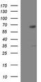 Golgi Associated, Gamma Adaptin Ear Containing, ARF Binding Protein 2 antibody, M04016, Boster Biological Technology, Western Blot image 