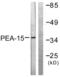 Proliferation And Apoptosis Adaptor Protein 15 antibody, LS-B6997, Lifespan Biosciences, Western Blot image 