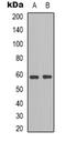 BLK Proto-Oncogene, Src Family Tyrosine Kinase antibody, orb339002, Biorbyt, Western Blot image 