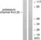 Potassium Voltage-Gated Channel Subfamily C Member 2 antibody, LS-B5982, Lifespan Biosciences, Western Blot image 