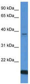 WD Repeat Domain 54 antibody, TA342976, Origene, Western Blot image 