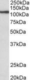 Natriuretic Peptide A antibody, 42-900, ProSci, Western Blot image 