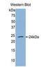TNF Receptor Superfamily Member 1A antibody, LS-C296885, Lifespan Biosciences, Western Blot image 