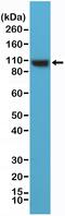 Actinin Alpha 4 antibody, MA5-27886, Invitrogen Antibodies, Western Blot image 