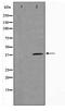 Tumor Suppressor Candidate 3 antibody, TA347683, Origene, Western Blot image 