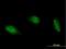 Adenosine Deaminase RNA Specific B1 antibody, H00000104-B02P, Novus Biologicals, Immunofluorescence image 