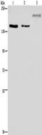 Lysine Demethylase 3B antibody, TA350103, Origene, Western Blot image 