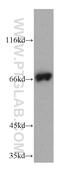 IL2 Inducible T Cell Kinase antibody, 21525-1-AP, Proteintech Group, Western Blot image 