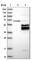 Fc Fragment Of IgE Receptor II antibody, HPA008928, Atlas Antibodies, Western Blot image 
