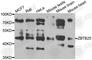 Zinc Finger And BTB Domain Containing 25 antibody, A7501, ABclonal Technology, Western Blot image 