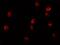 Lysine Demethylase 6B antibody, NBP2-82107, Novus Biologicals, Immunofluorescence image 