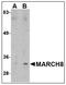 E3 ubiquitin-protein ligase MARCH8 antibody, AP23000PU-N, Origene, Western Blot image 