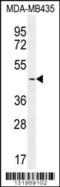 Lymphoid Enhancer Binding Factor 1 antibody, TA324467, Origene, Western Blot image 