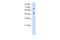 THO Complex 1 antibody, A04626, Boster Biological Technology, Western Blot image 