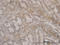 Forkhead Box O3 antibody, LS-C133203, Lifespan Biosciences, Immunohistochemistry paraffin image 