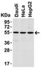 Interleukin 1 Receptor Associated Kinase 4 antibody, A01247-1, Boster Biological Technology, Western Blot image 
