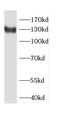 Codanin-1 antibody, FNab01514, FineTest, Western Blot image 