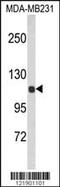 Actinin Alpha 1 antibody, MBS9202322, MyBioSource, Western Blot image 