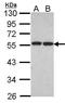 Fas Associated Factor Family Member 2 antibody, TA308376, Origene, Western Blot image 
