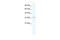 Nudix Hydrolase 9 antibody, 28-309, ProSci, Western Blot image 