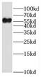 Sialic Acid Binding Ig Like Lectin 9 antibody, FNab07863, FineTest, Western Blot image 