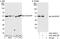 Rho GTPase Activating Protein 1 antibody, A301-853A, Bethyl Labs, Western Blot image 