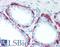 Keratin 5 antibody, LS-B16140, Lifespan Biosciences, Immunohistochemistry paraffin image 