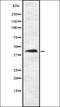 Potassium Two Pore Domain Channel Subfamily K Member 3 antibody, orb337416, Biorbyt, Western Blot image 