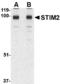 Stromal Interaction Molecule 2 antibody, MBS150254, MyBioSource, Western Blot image 